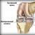 Как защитить коленные суставы во время тренировки Препараты для укрепления суставов